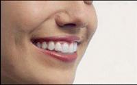 Invisalign